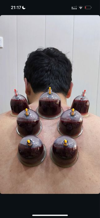 ХИДЖАМА | Астана