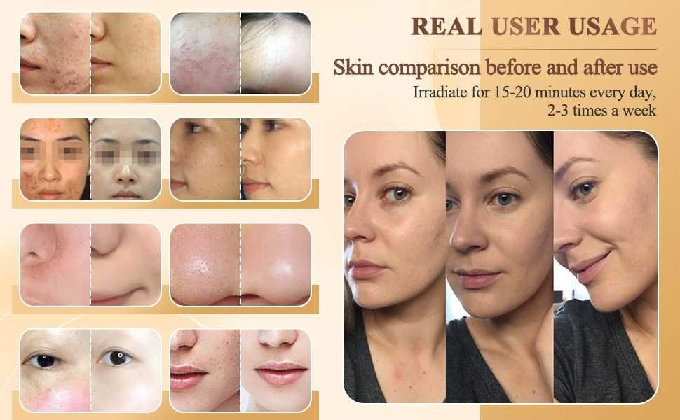 LED маска за лице и фотон терапия ForeverLily LM с 7 LED светлини