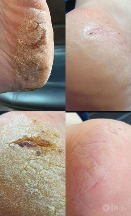 Педикюр , маникюр для пожилых: бережно , безопасно, без стресса