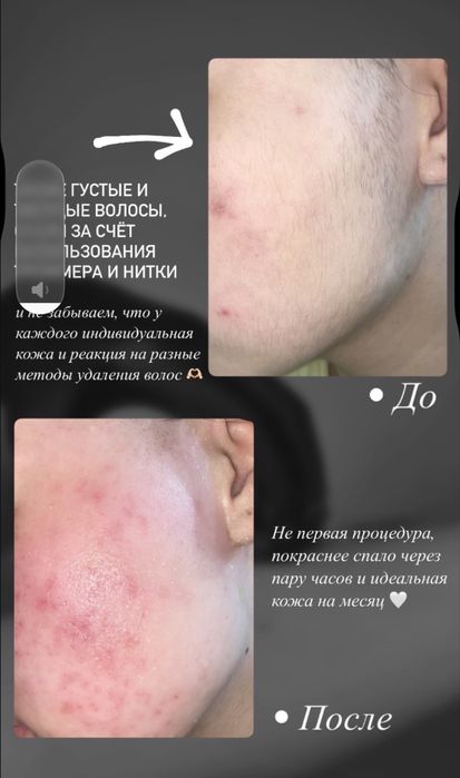 Мастер шугаринга на выезд!! только женщины