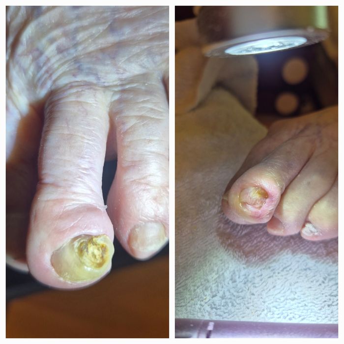 Pedichiura curativa