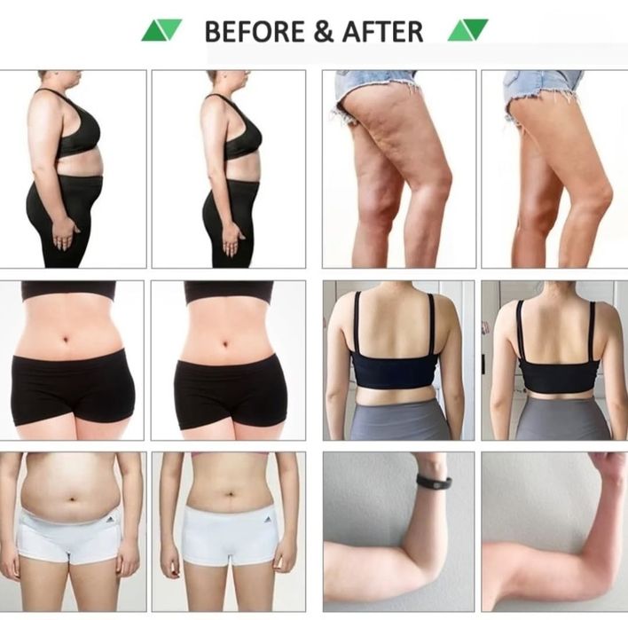 10D MAXLIPOLASER aparat remodelare si terapie corporală ca nou.