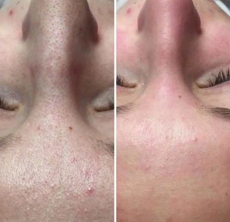 Обучение  на мастера