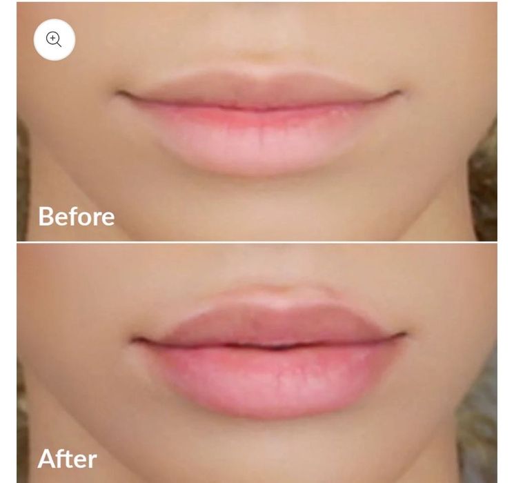 PMD Beauty Kiss Система за увеличаване на обема на устните със серум