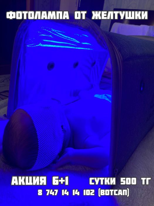 Фотолампа от желтушки