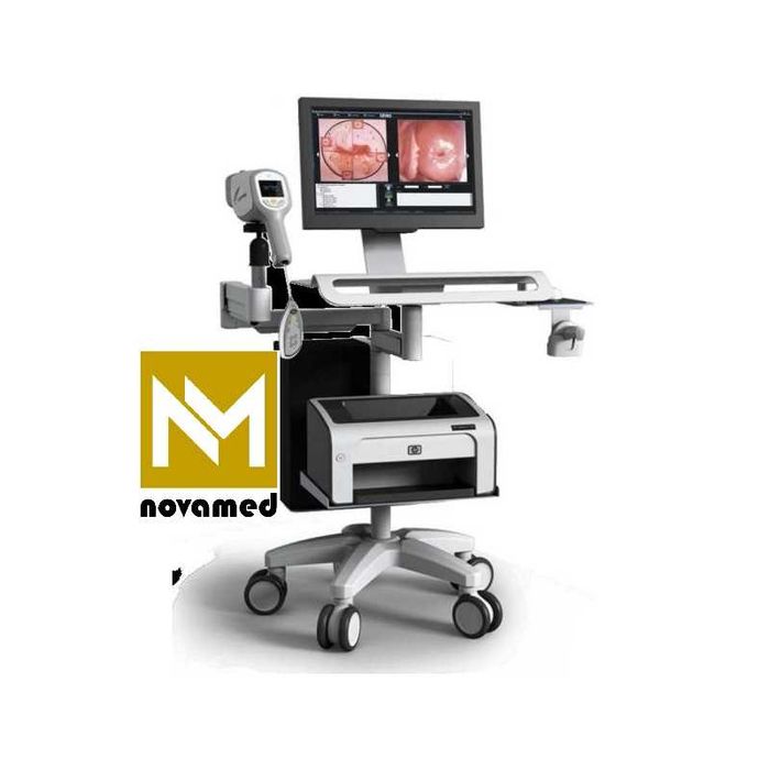 Видеокольпоскоп Kernel модели KN-2200