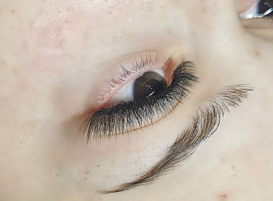 Extensii de gene 1-5D