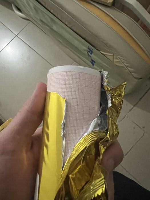 Лента узи,экг.