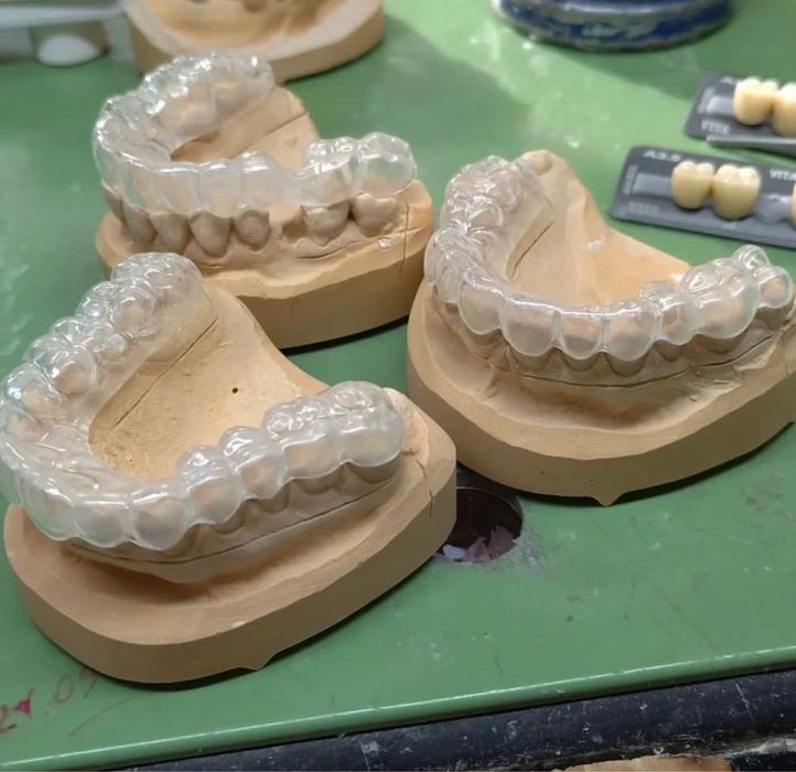 Зубной каппа после брекет