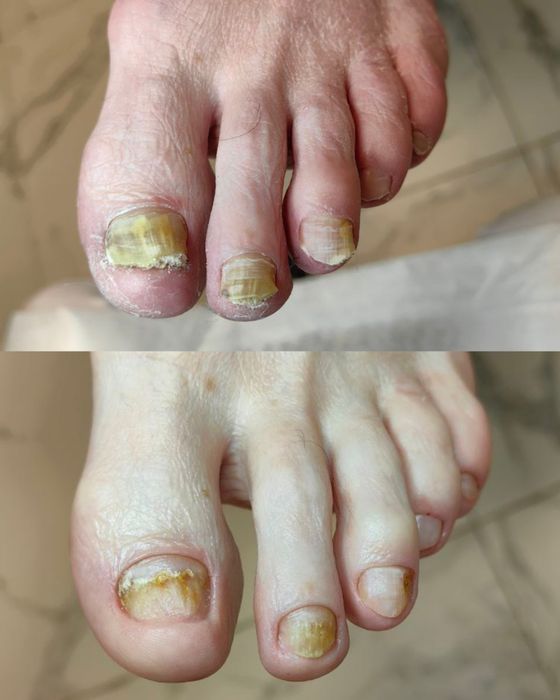 Педикюр  педикюр