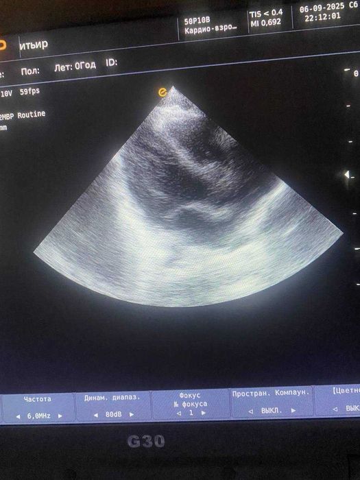 Портативный УЗИ аппарат EMP G30