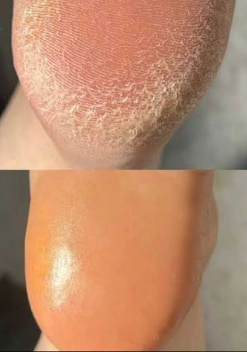 55 Lei Ofer sercivii de cosmetizare calcaie si pedichiura cosmetica  la domiciliul clientei - Bucuresti