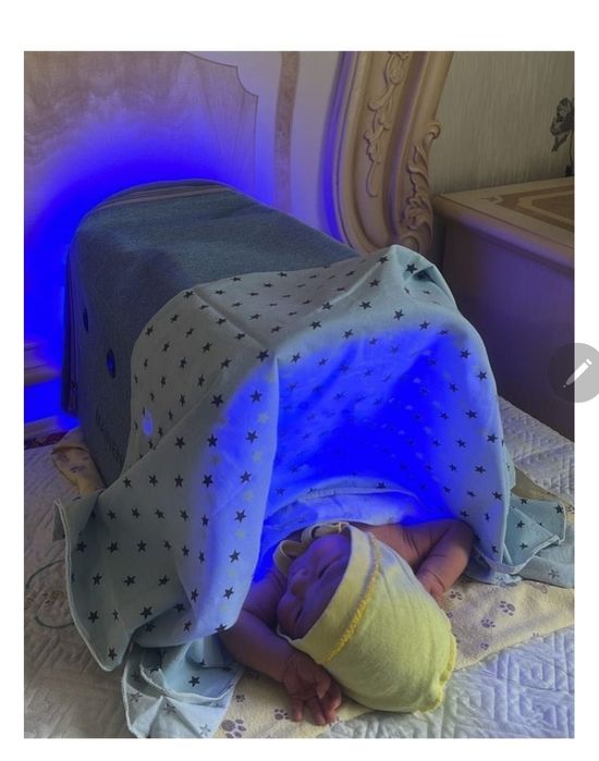 Фотолампа билитест каскелен