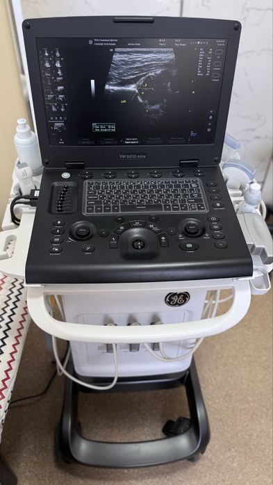 УЗИ аппарат General Electric GE Versana портативный