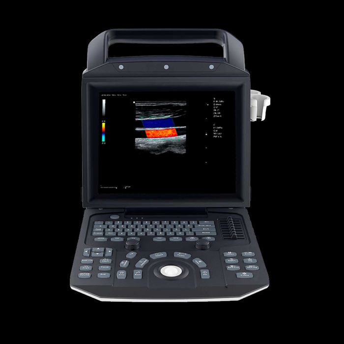Ультразвуковая диагностическая система (УЗИ аппараты) UZI APPARAT