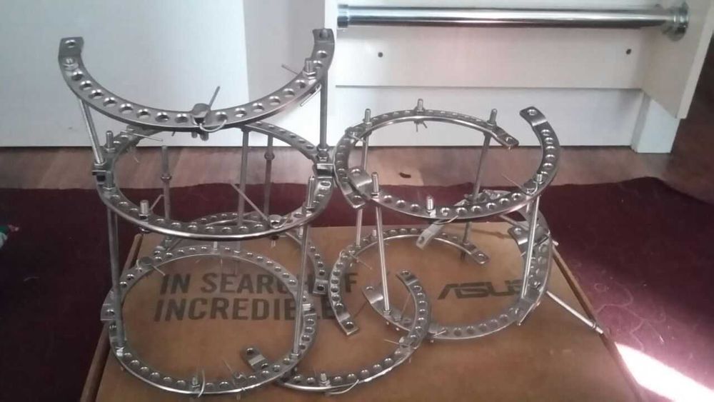 аппарат илизарова