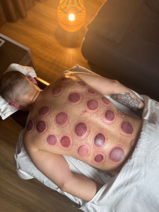 Masaj Deep Tissue, Sportiv, Fire Cupping, Thai - Relaxare & Recuperare