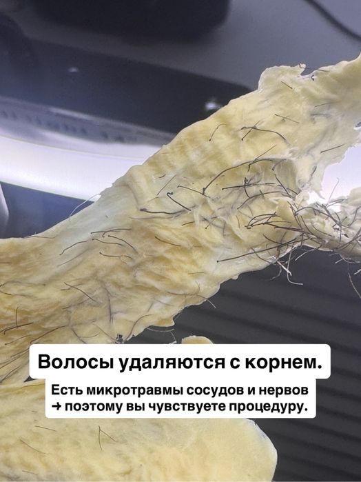 Шугаринг, депиляция полимером