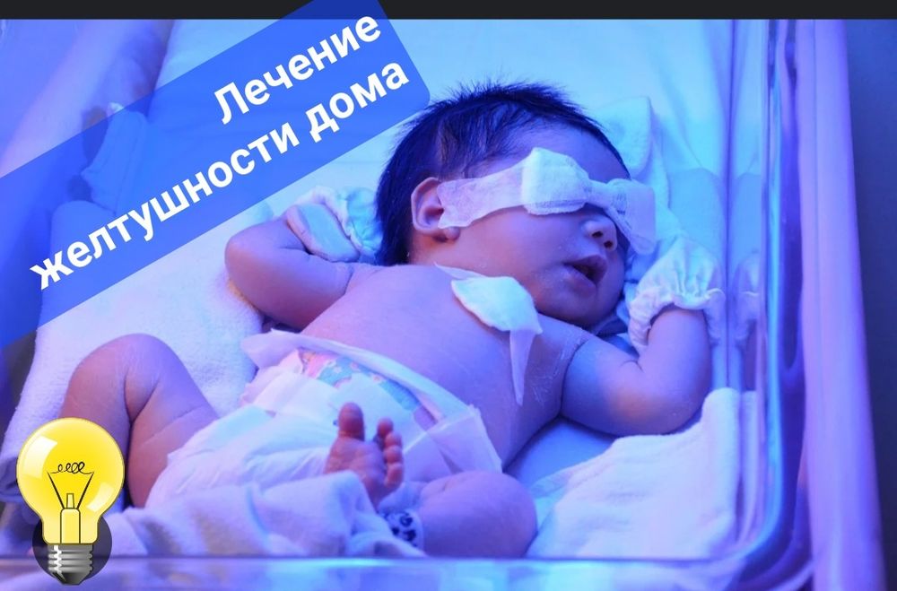 Фотолампа от желтухи