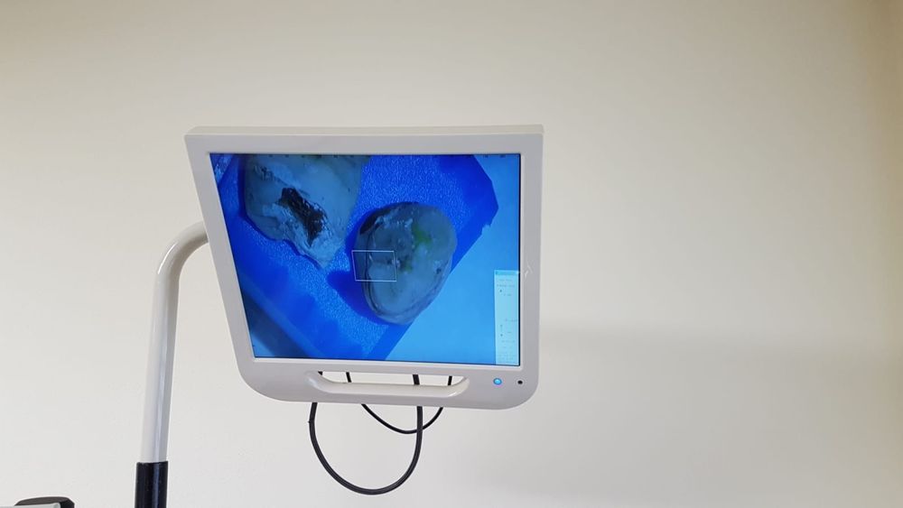 Microscop stomatologic/ dentar/ endodontic