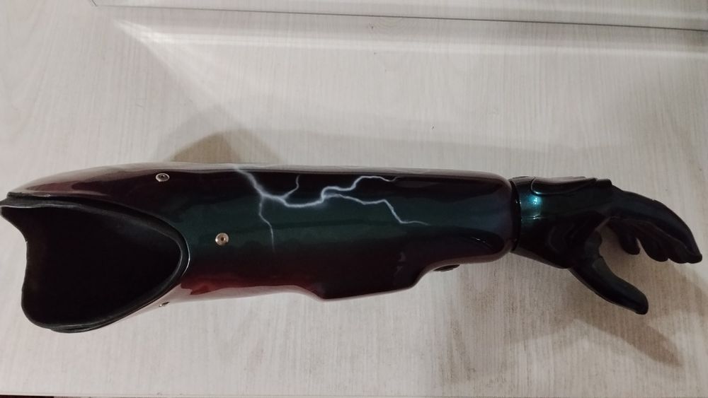 Бионический протез