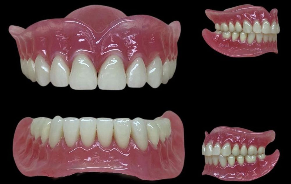 Протезы ,Циркон, Керамика , Виниры!