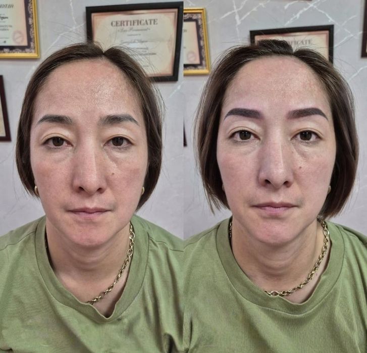 Действует до 8 ноября.