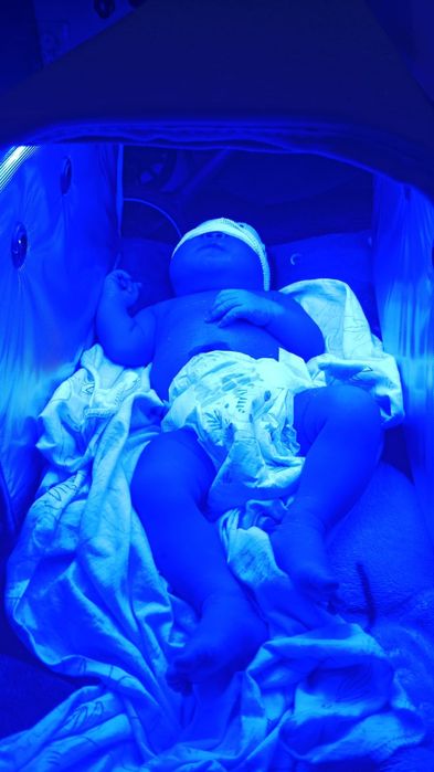 Лампа от желтушки