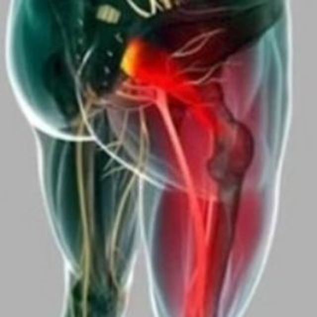Остеопат - невропатолог Астана