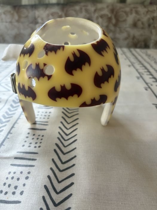 Детский ортопедический шлем