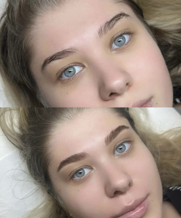 Indepartare stergere sprancene,tatuaje nedorite 250 lei sedinta