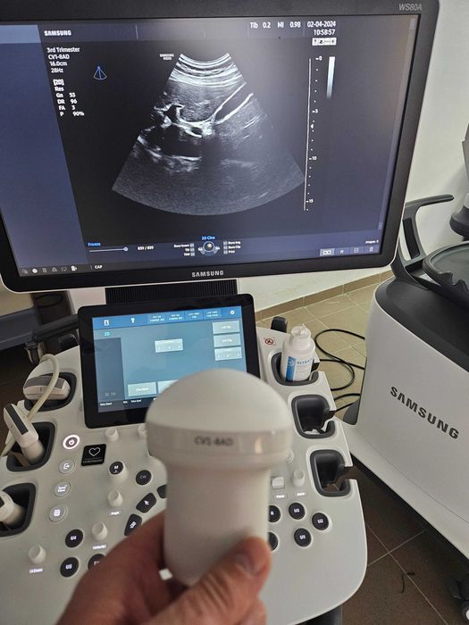 Reparatii si mentenata ecografe(Autorizat ANMDMR)