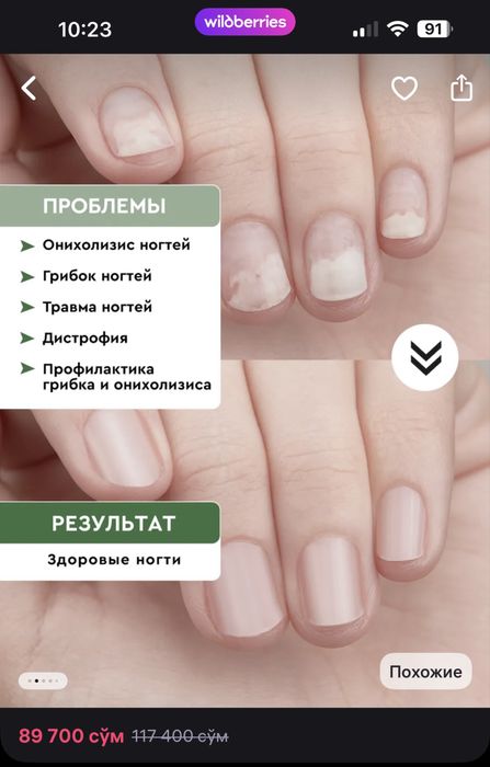 Сыворотка для ногтей стоп онихолизис