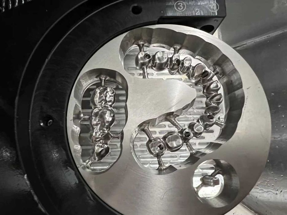 3D-сканеры и CAD/CAM системы в зуботехнической лаборатории