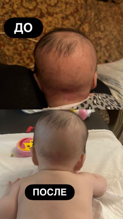 Детский массажист