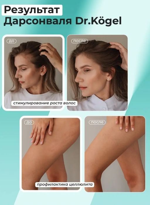 Дарсонваль аппарат для лица, тела и волос