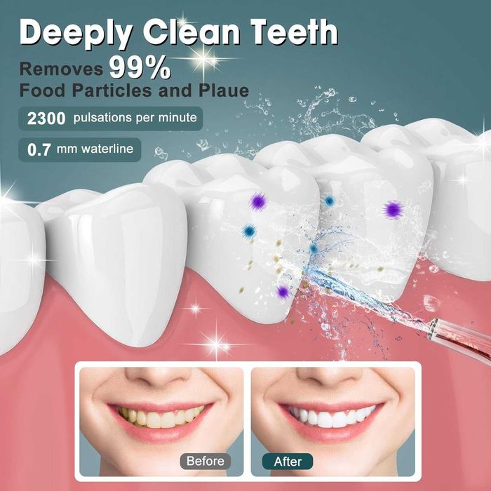 NIMMU Конец за зъби