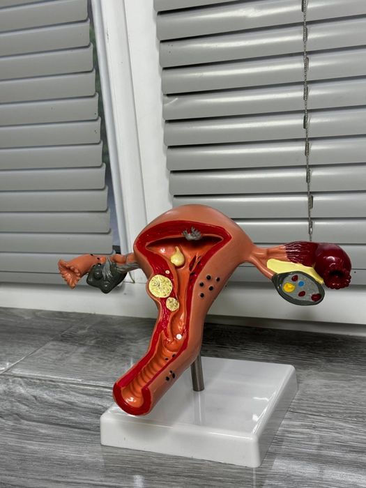 Анатомический муляж сердца, матка, глотка