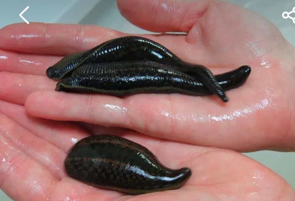 Хижама ва зулук куйиш даволаш