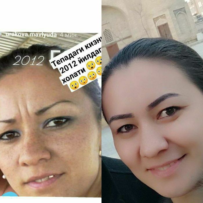 Oqartiruvchi krem. Koreya mahsuloti original. Kremi toza yuzga masajni