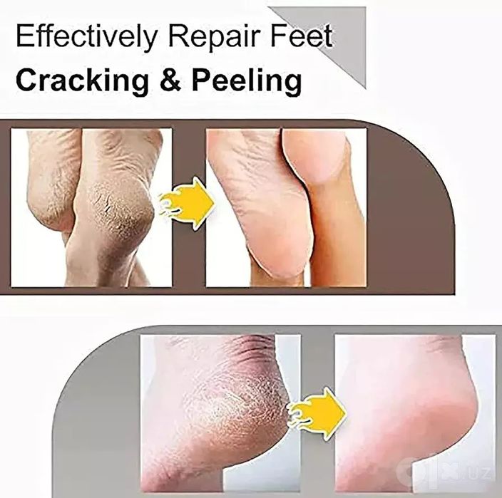Yorilishga qarshi tovon kremi Anti crack, quruq teri uchun namlovchi k