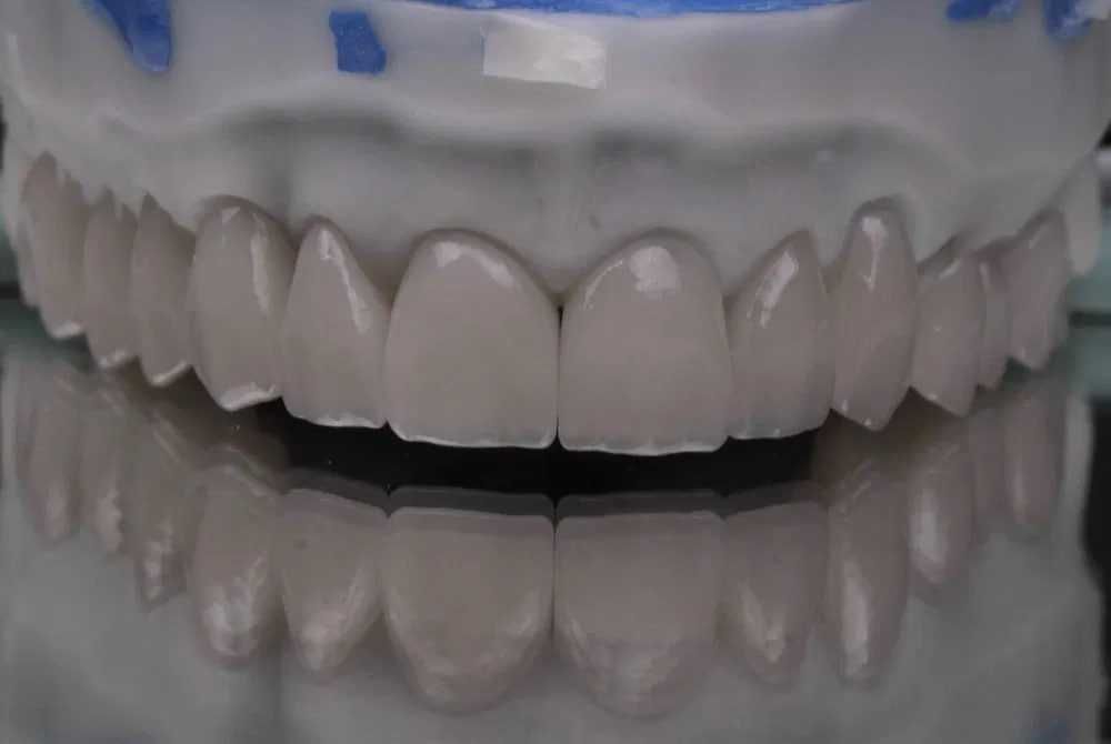 Фрезерный центр CAD/CAM Зуботехническая лаборатория