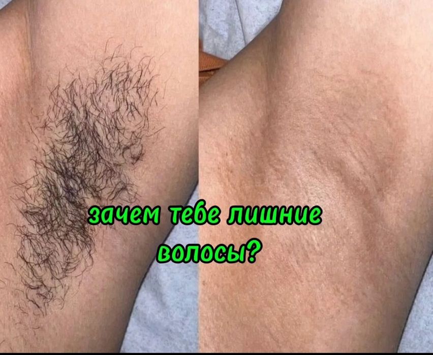 Депиляция сахаром. Персидский шугаринг мужчинам.