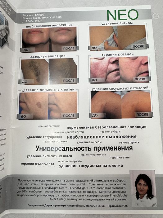 Продам лазерный аппарат Aerolase