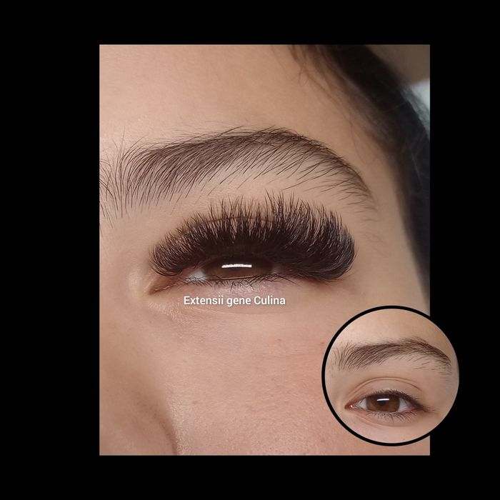 Extensii gene Galați