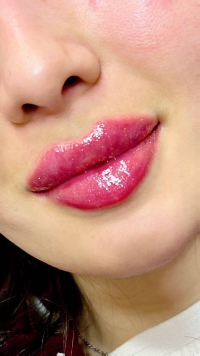 Косметолог эстет все уход и инъекционные процедуры