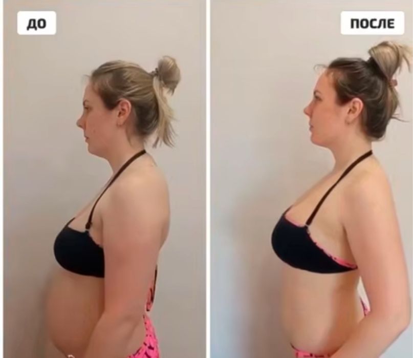 Коррекция фигуры