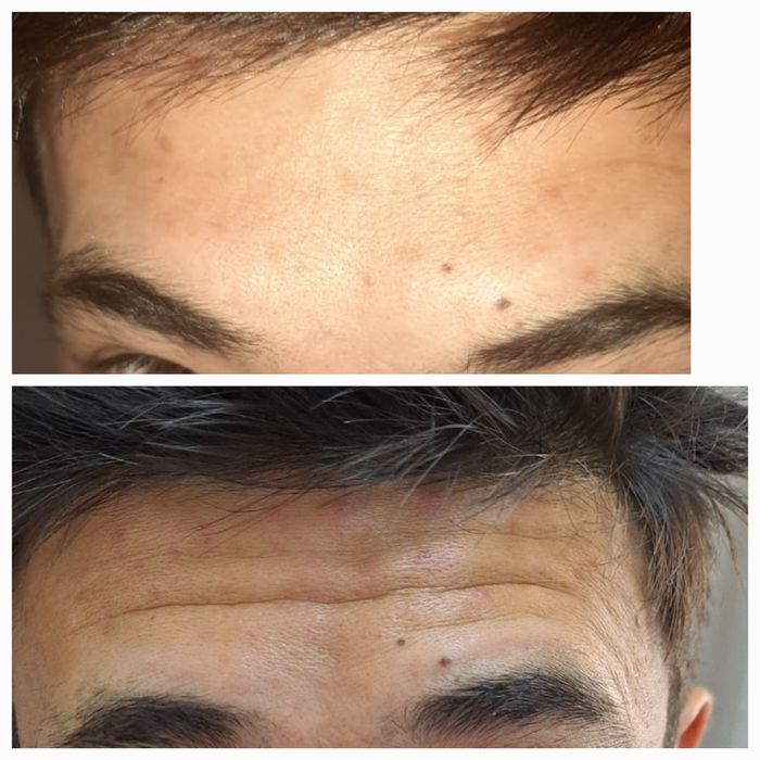 Депиляция г. АЛМАТЫ