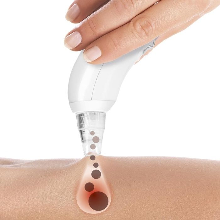 Вакуумен уред за почистване на кожата и порите VITALmaxx Pore Cleaner