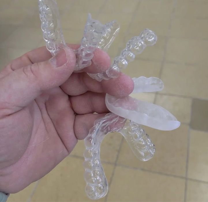 Зубной каппа после брекет